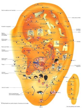Auriculothérapie